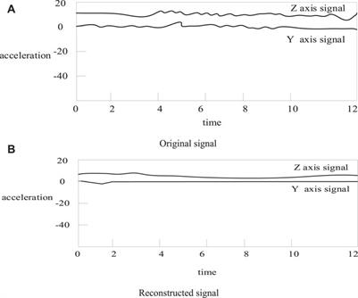 Application of Tissue Engineered Nanomaterials in Meniscus Sports Injury Repair